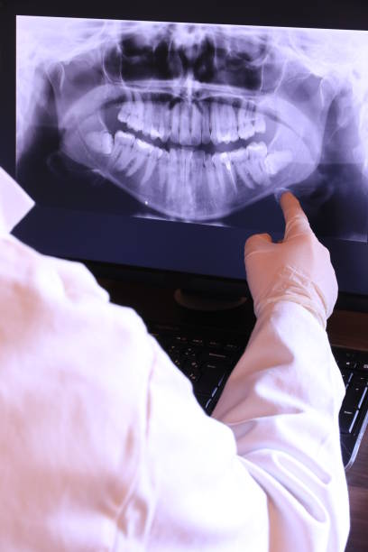 Best Emergency Tooth Extraction in Orangevale, CA