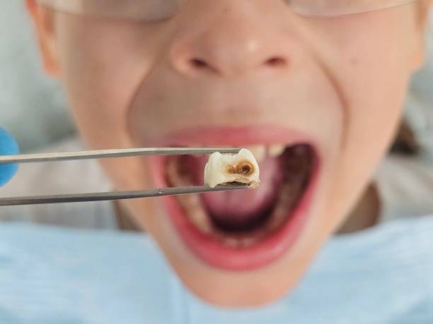 Best Same-Day Emergency Dentist in Orangevale, CA